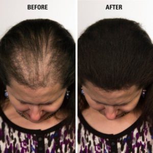 Dr. Hair USA – 2nd Generation Hair Building Fiber –  USA