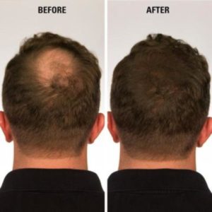 Dr. Hair USA – 2nd Generation Hair Building Fiber – USA Dr. Hair USA – 2nd Generation Hair Building Fiber – USA