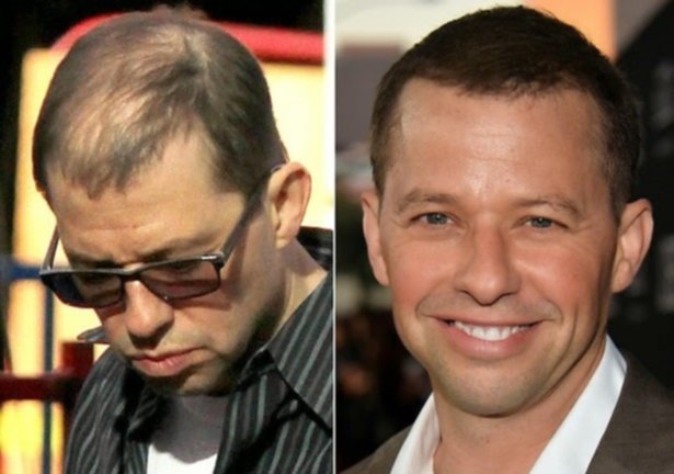 Hollywood Celebrities Using Hair Fiber Say It Isn T So Dr Hair Usa